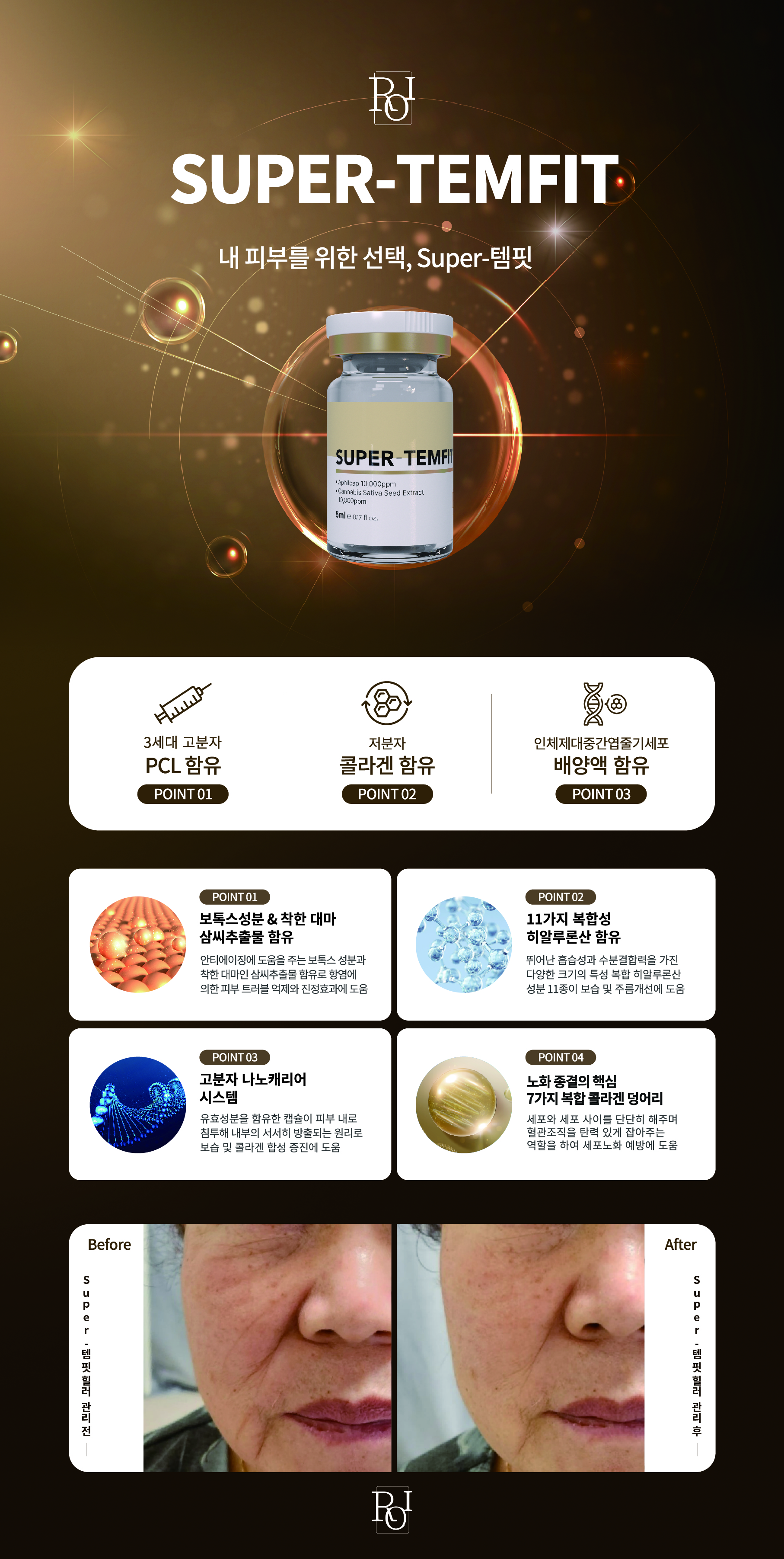 슈퍼템핏 앰플