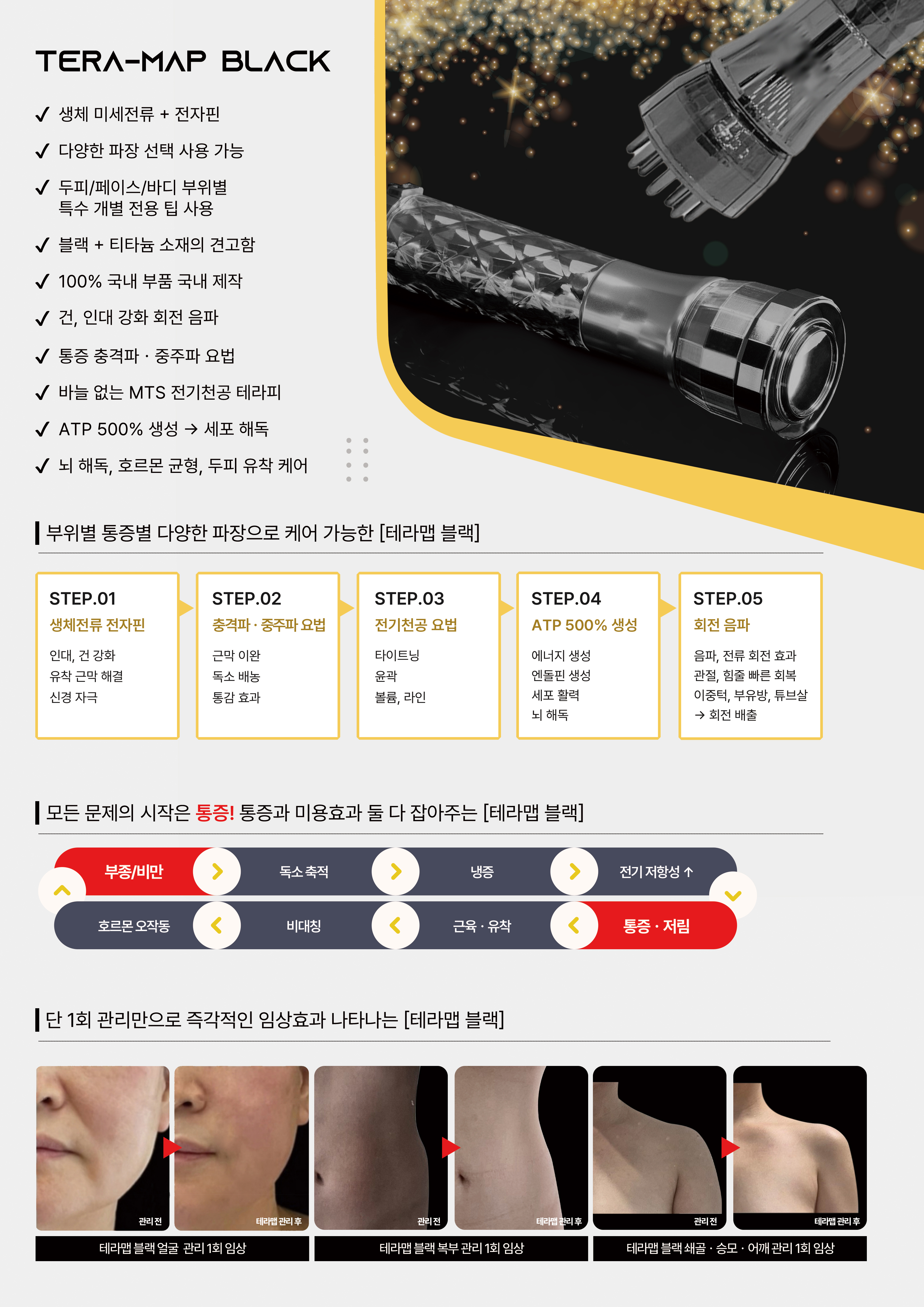 테라맵 블랙 뒤